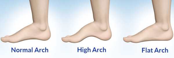 Flat Foot Test | lupon.gov.ph