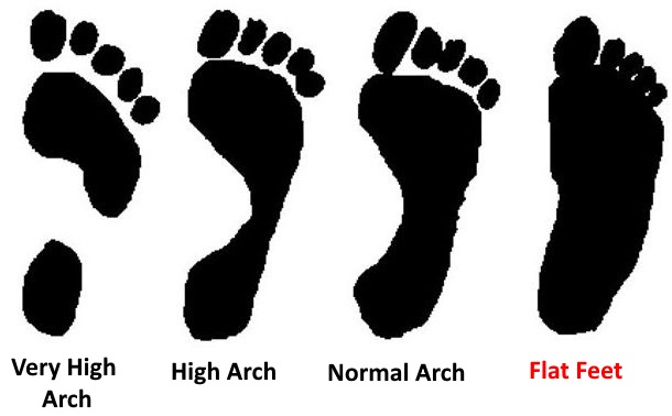 footprint test for flat feet